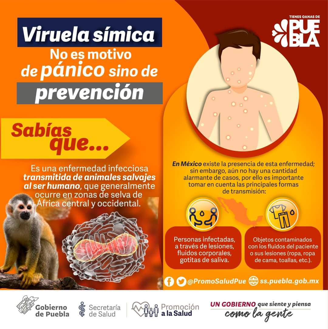 Información Viruela Símica